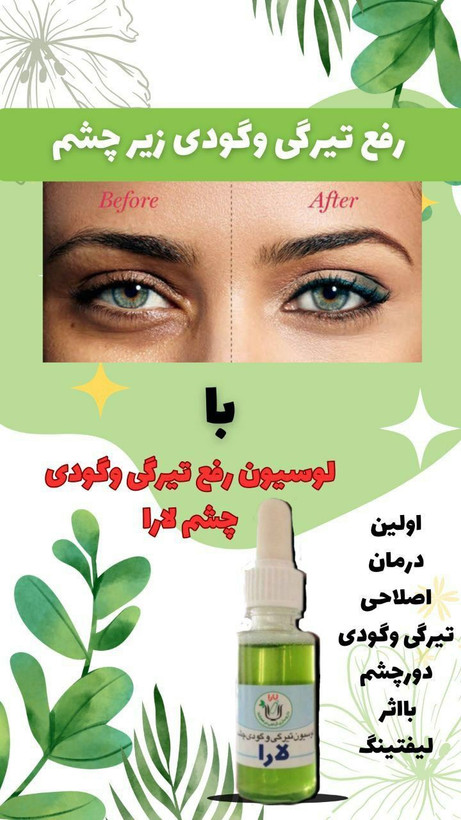 لوسیون رفع تیرگی و گودی زیر چشم کیفیت عالی جوابدهی بی نظیر